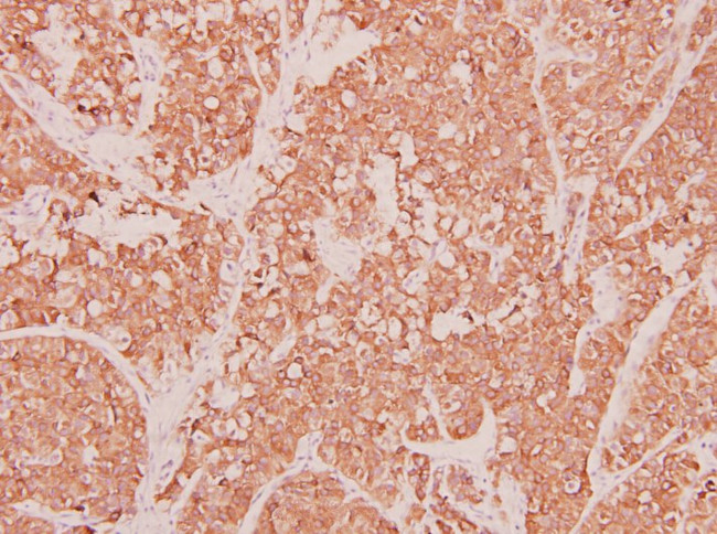 CCL3 Antibody in Immunohistochemistry (Paraffin) (IHC (P))