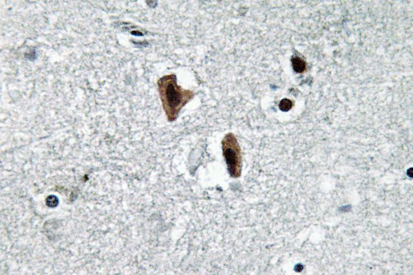 Lamin B1 Antibody in Immunohistochemistry (Paraffin) (IHC (P))