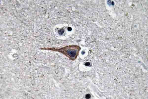 EGF Antibody in Immunohistochemistry (Paraffin) (IHC (P))