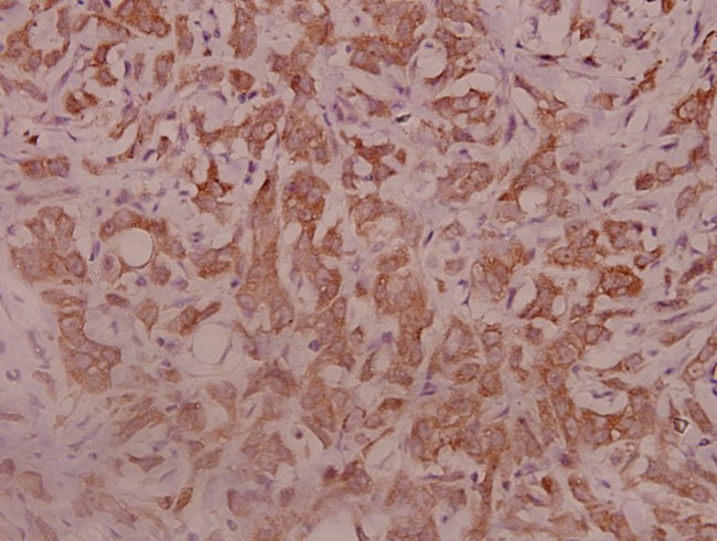 IL5RA Antibody in Immunohistochemistry (Paraffin) (IHC (P))