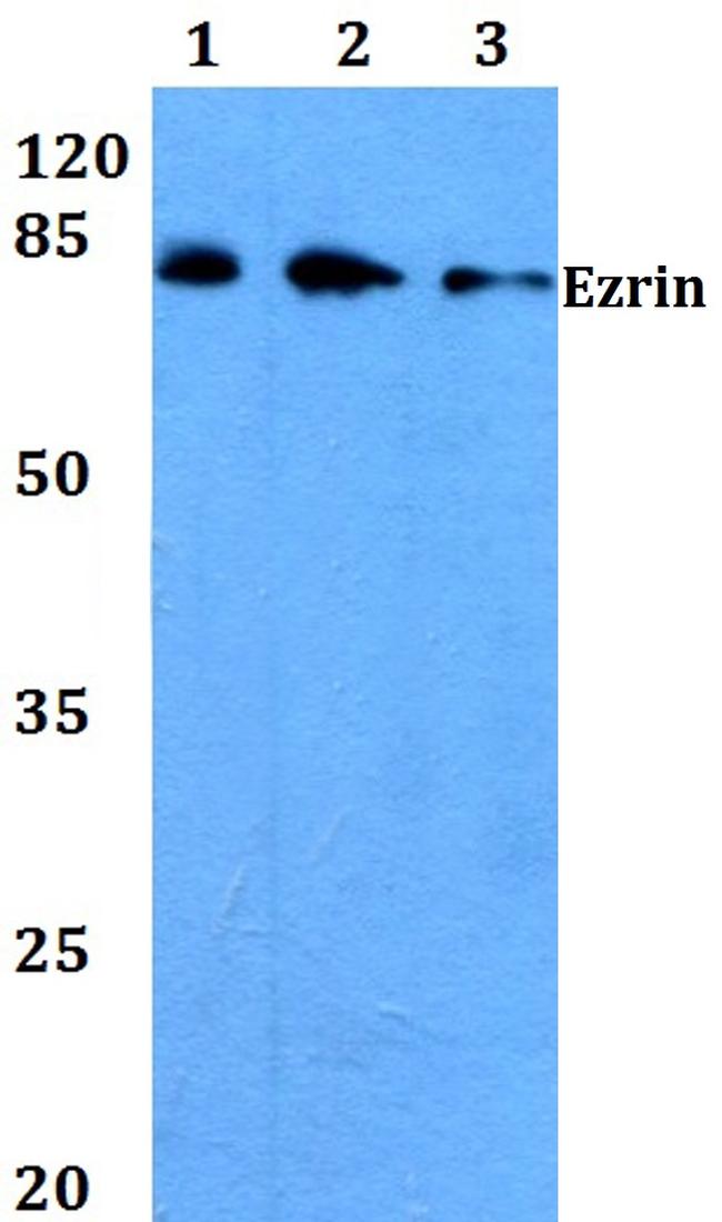 Ezrin Antibody in Western Blot (WB)