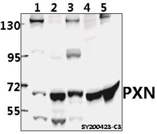 Paxillin Antibody in Western Blot (WB)