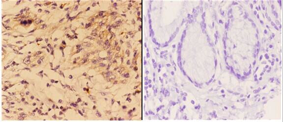 4EBP1 Antibody in Immunohistochemistry (Paraffin) (IHC (P))