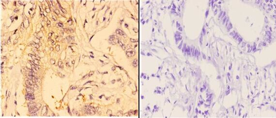 4EBP1 Antibody in Immunohistochemistry (Paraffin) (IHC (P))