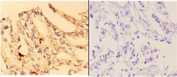 4EBP1 Antibody in Immunohistochemistry (Paraffin) (IHC (P))