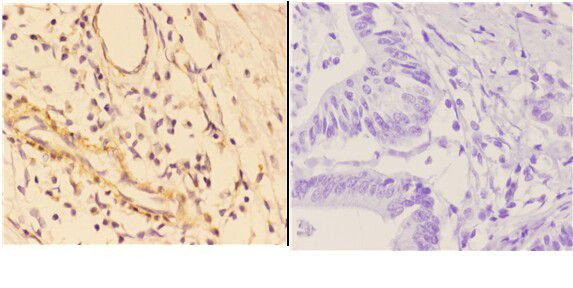 4EBP1 Antibody in Immunohistochemistry (Paraffin) (IHC (P))