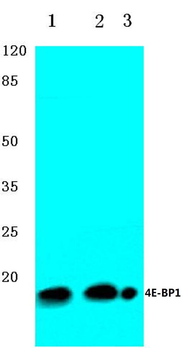 4EBP1 Antibody in Western Blot (WB)