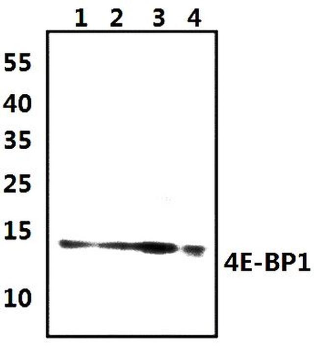 4EBP1 Antibody in Western Blot (WB)