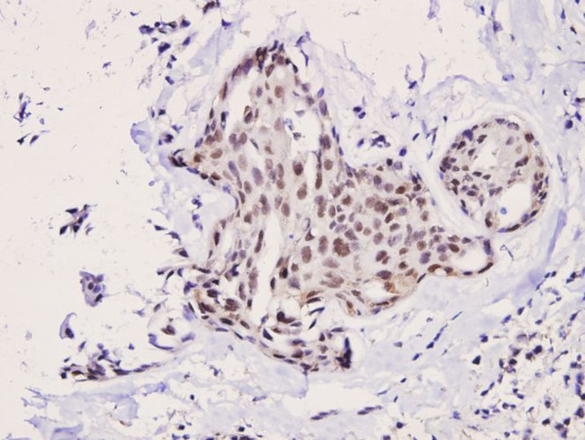 p70 S6 Kinase Antibody in Immunohistochemistry (Paraffin) (IHC (P))