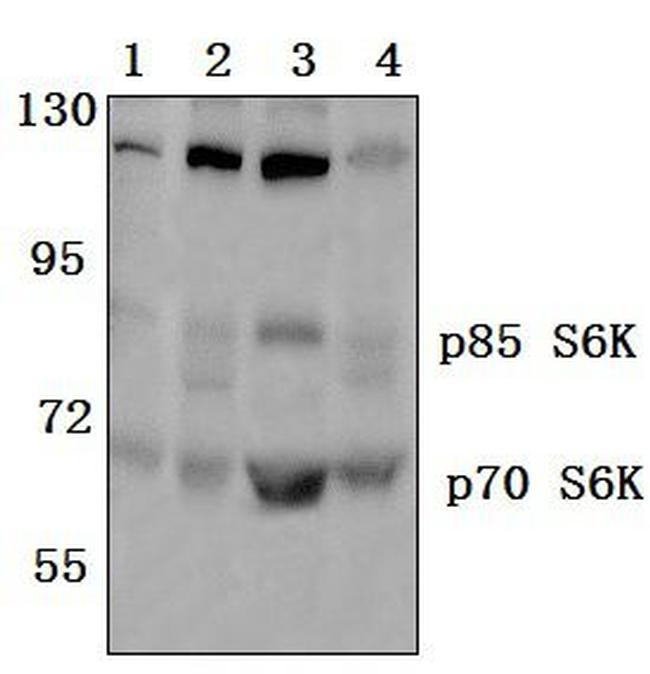 p70 S6 Kinase Antibody in Western Blot (WB)