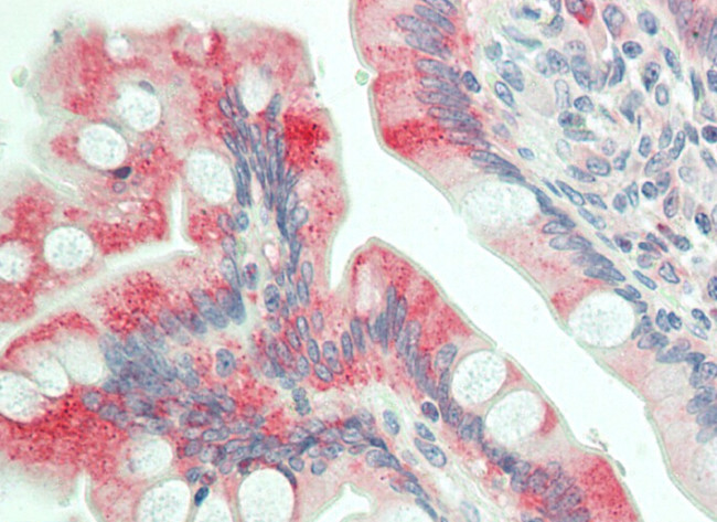 DAB1 Antibody in Immunohistochemistry (Paraffin) (IHC (P))