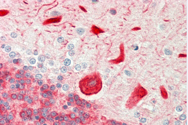 DAB1 Antibody in Immunohistochemistry (Paraffin) (IHC (P))