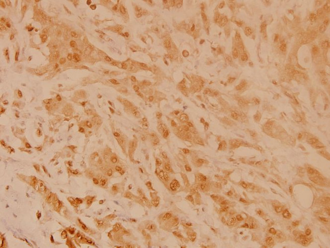 GAP43 Antibody in Immunohistochemistry (Paraffin) (IHC (P))