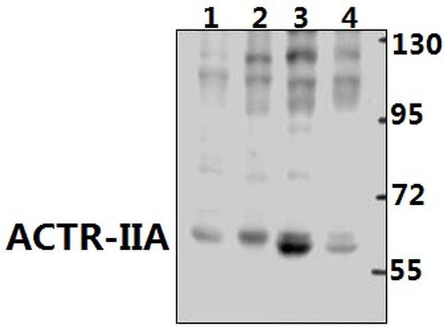 ACVR2A Antibody in Western Blot (WB)