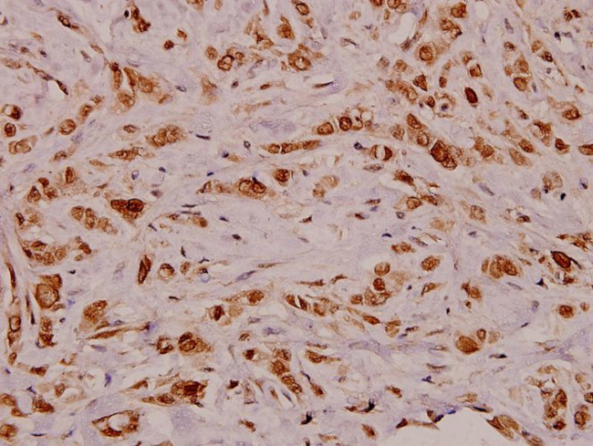 VEGFD Antibody in Immunohistochemistry (Paraffin) (IHC (P))