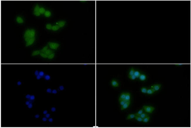 PI3K p85 alpha Antibody in Immunocytochemistry (ICC/IF)