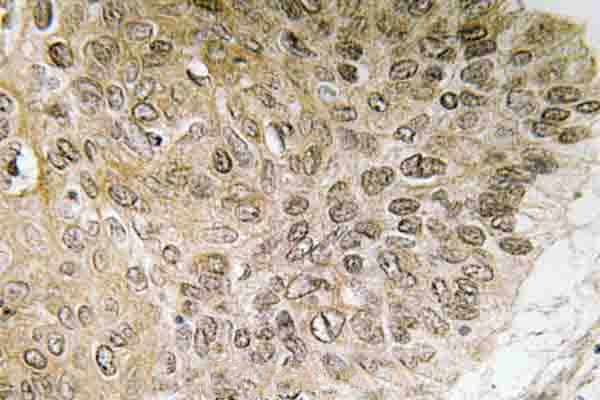 PI3K p85 alpha Antibody in Immunohistochemistry (Paraffin) (IHC (P))