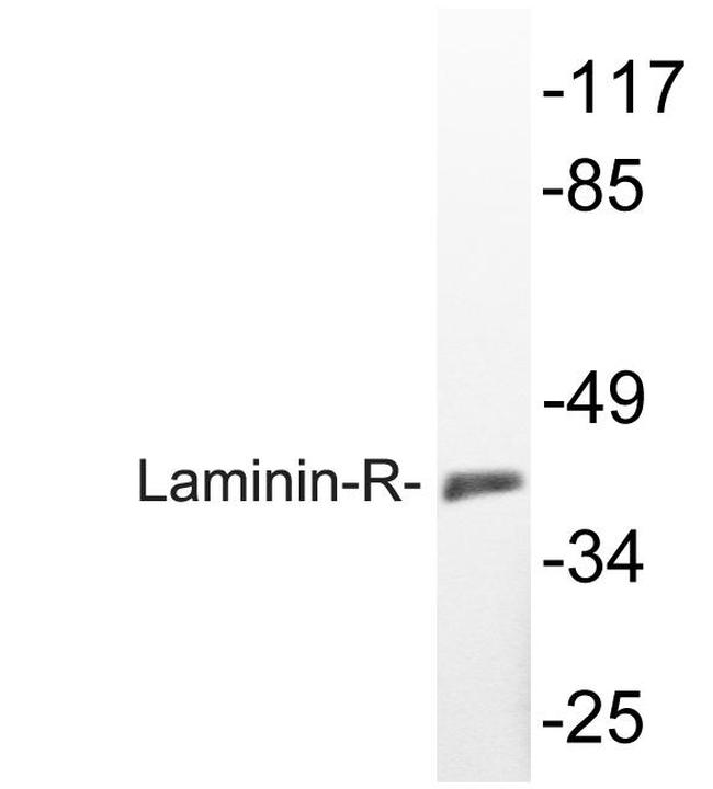 RPSA Antibody in Western Blot (WB)