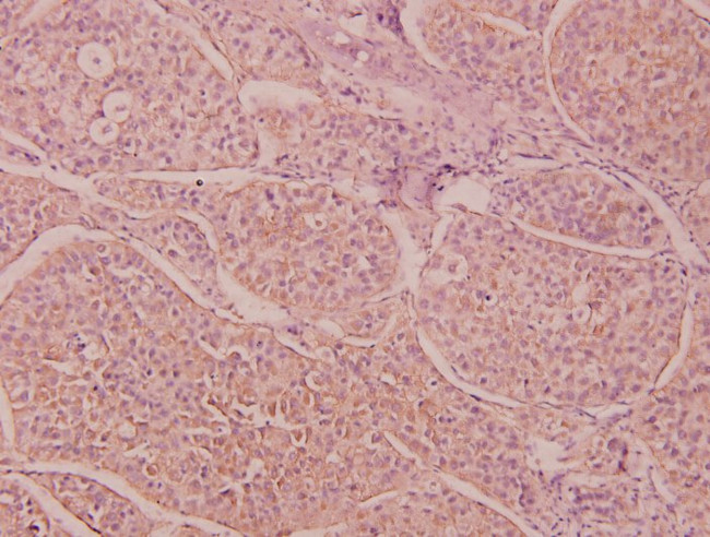 IL-16 Antibody in Immunohistochemistry (Paraffin) (IHC (P))