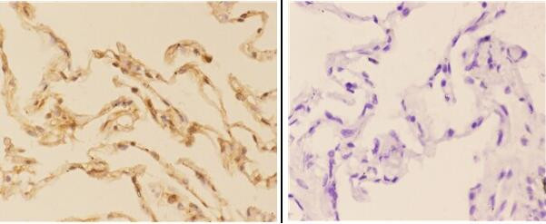 Acetylcholinesterase Antibody in Immunohistochemistry (Paraffin) (IHC (P))