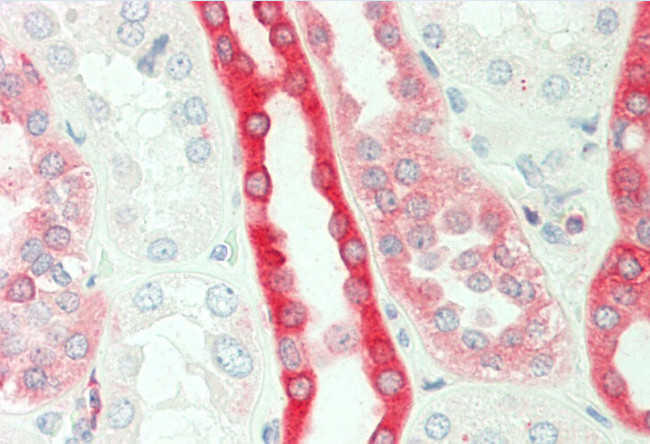 PKC beta Antibody in Immunohistochemistry (Paraffin) (IHC (P))