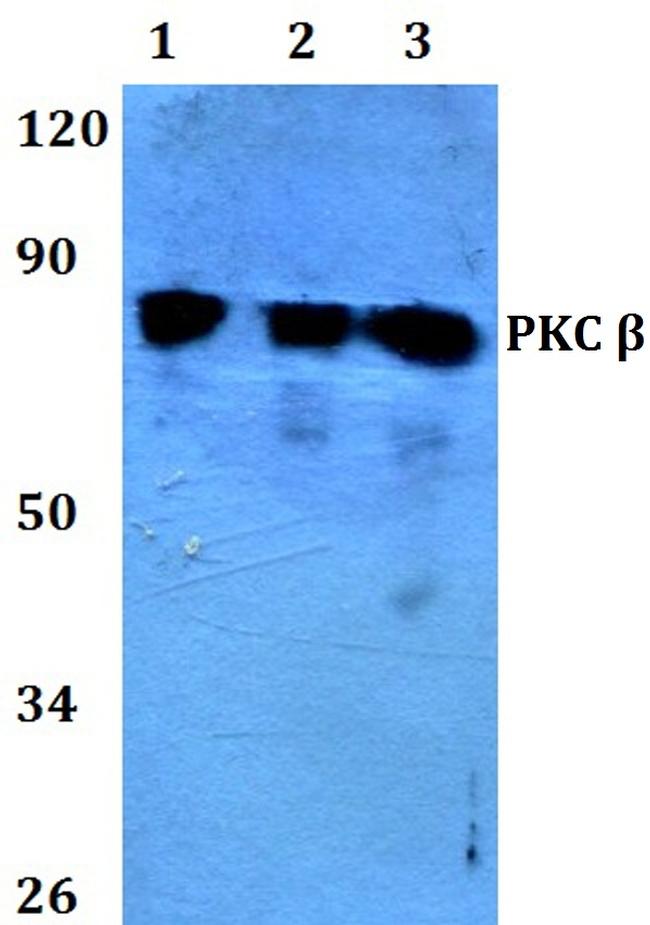 PKC beta Antibody in Western Blot (WB)