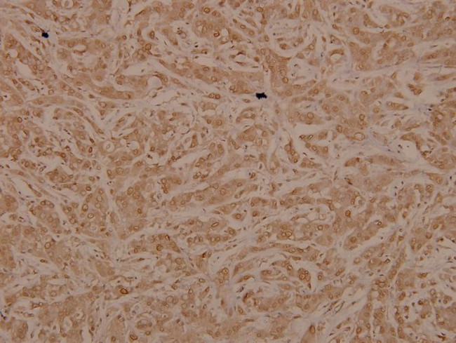 TAK1 Antibody in Immunohistochemistry (Paraffin) (IHC (P))