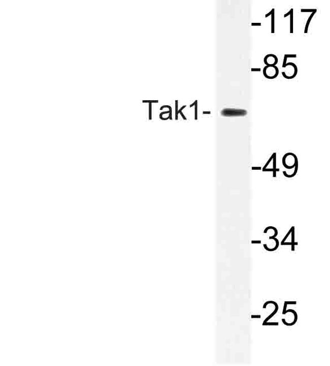 TAK1 Antibody in Western Blot (WB)