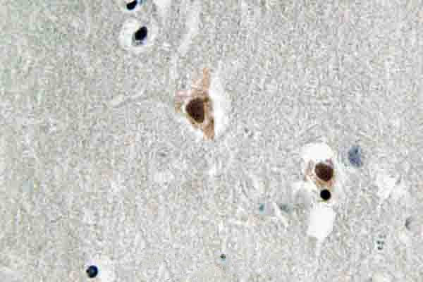 MEF2C Antibody in Immunohistochemistry (Paraffin) (IHC (P))