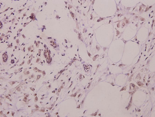 RAD51 Antibody in Immunohistochemistry (Paraffin) (IHC (P))