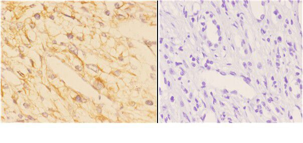 ACAT1 Antibody in Immunohistochemistry (Paraffin) (IHC (P))