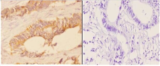 ACAT1 Antibody in Immunohistochemistry (Paraffin) (IHC (P))