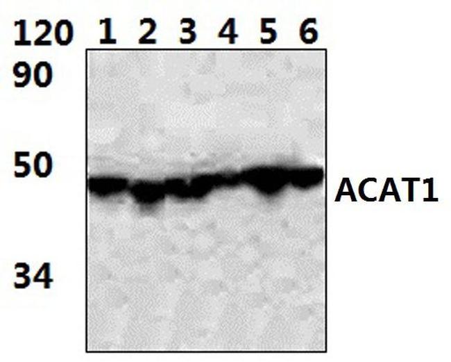 ACAT1 Antibody in Western Blot (WB)