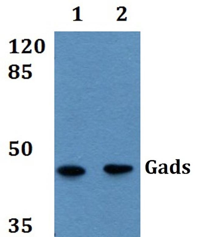 GRAP2 Antibody in Western Blot (WB)