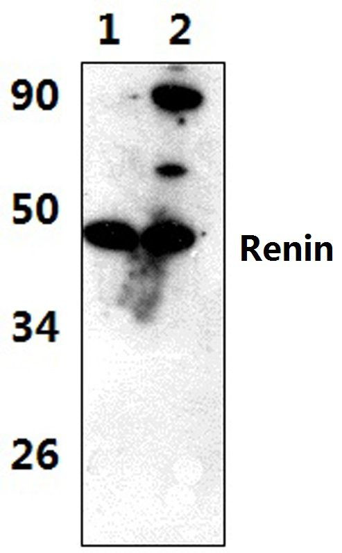 Renin Antibody in Immunohistochemistry (Paraffin) (IHC (P))