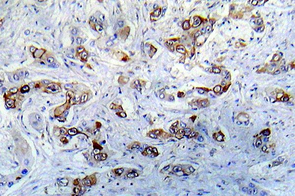 CaMKII alpha Antibody in Immunocytochemistry (ICC/IF)