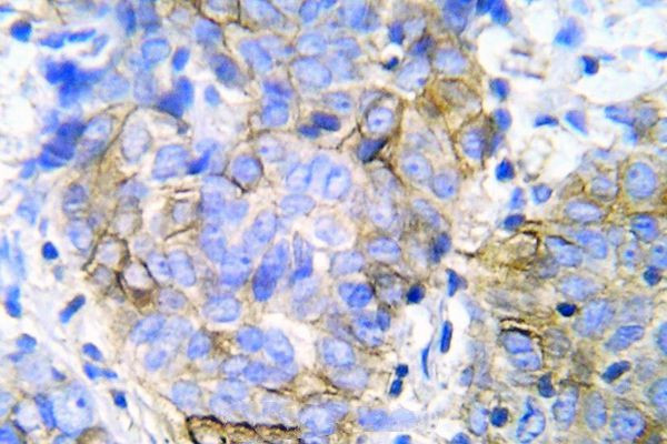 JAK1 Antibody in Immunohistochemistry (Paraffin) (IHC (P))