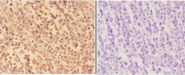 AKR1A1 Antibody in Immunohistochemistry (Paraffin) (IHC (P))