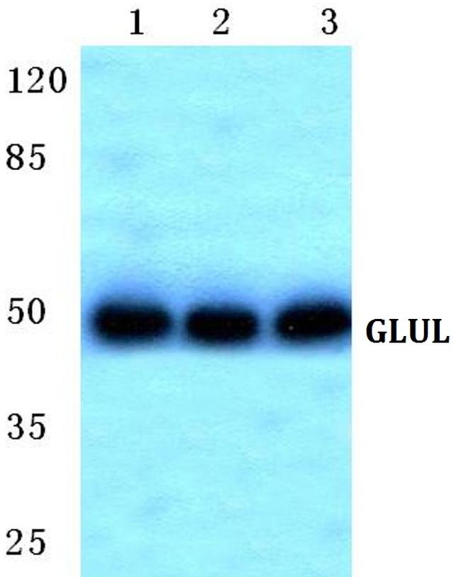 Glutamine Synthetase Antibody in Western Blot (WB)