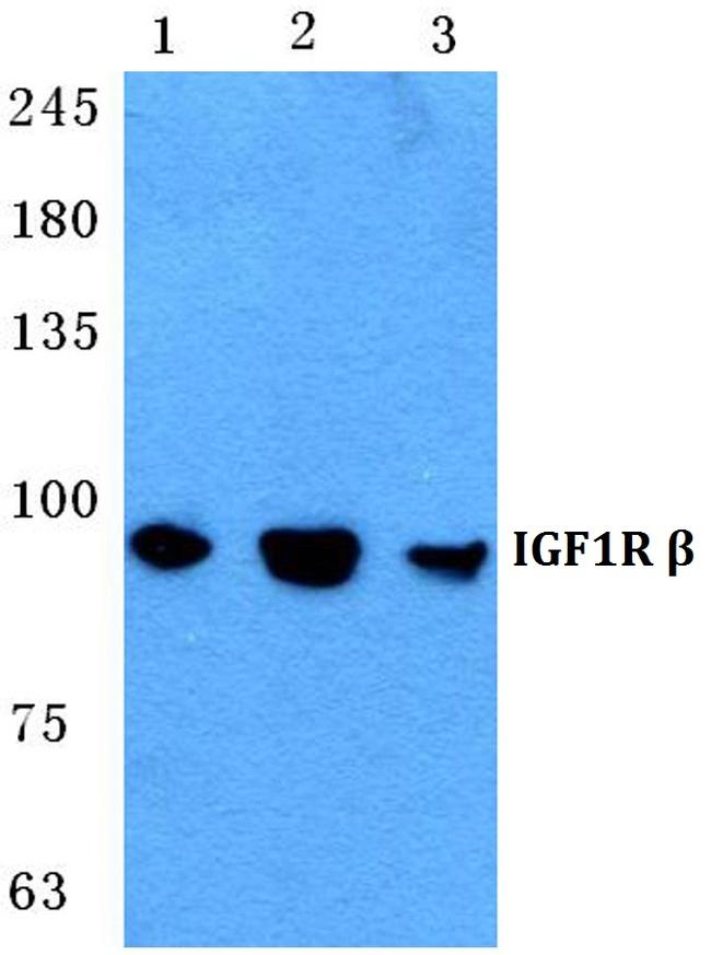 IGF1R alpha Antibody in Western Blot (WB)