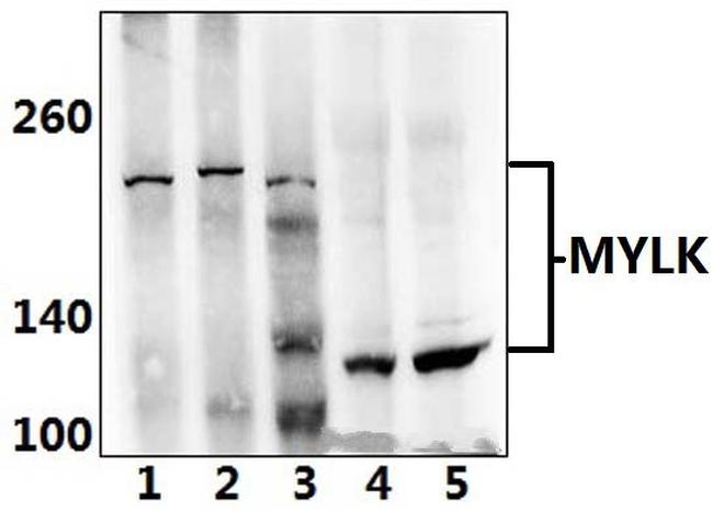 MYLK Antibody in Western Blot (WB)