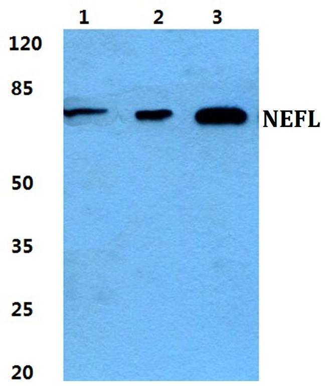 NEFL Antibody in Western Blot (WB)
