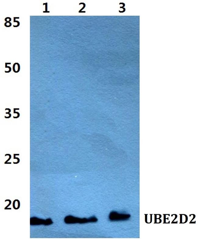 UBE2D2 Antibody in Western Blot (WB)