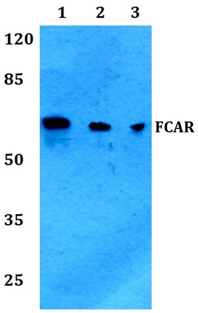 FCAR Antibody in Western Blot (WB)