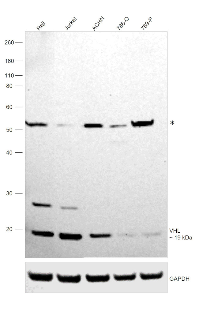 VHL Antibody in Western Blot (WB)