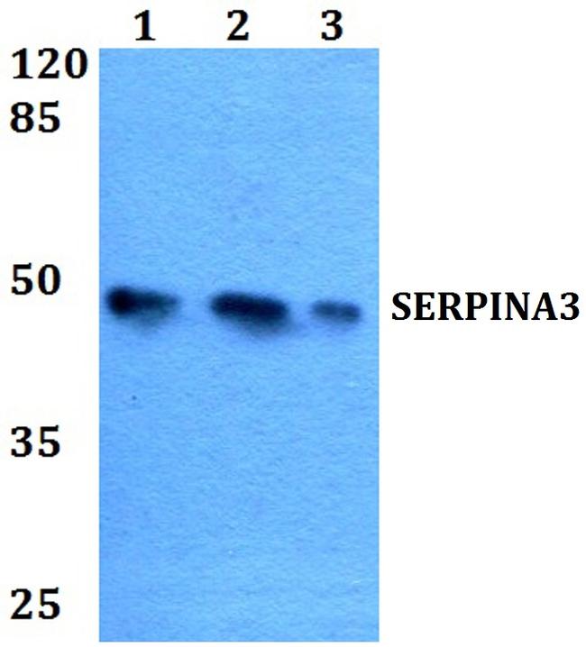 SERPINA3 Antibody in Western Blot (WB)