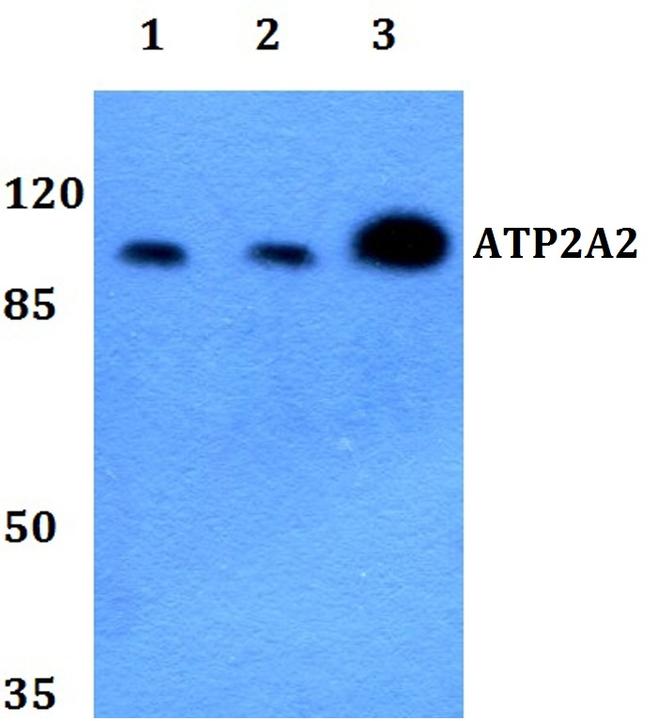 SERCA2 ATPase Antibody in Western Blot (WB)