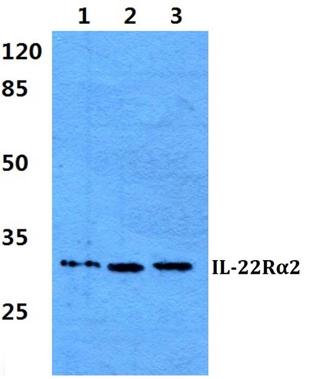 IL22RA2 Antibody in Western Blot (WB)