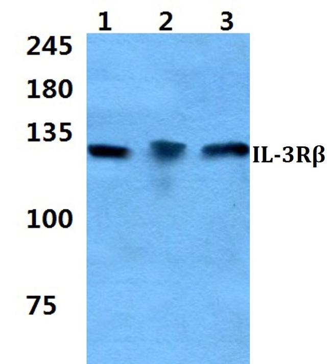 CSF2RB Antibody in Western Blot (WB)