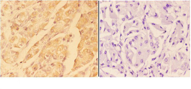 ADAM10 Antibody in Immunohistochemistry (Paraffin) (IHC (P))